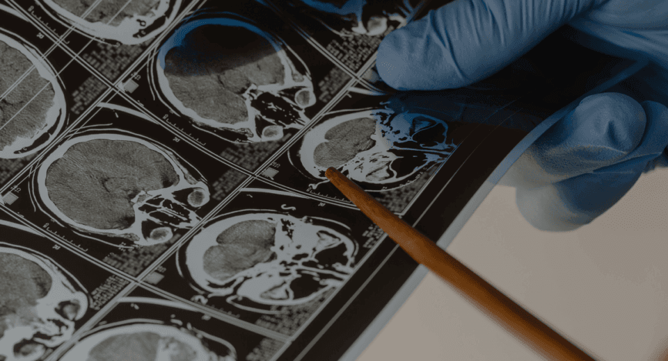 Prudential Panel Neurosurgeons in Singapore