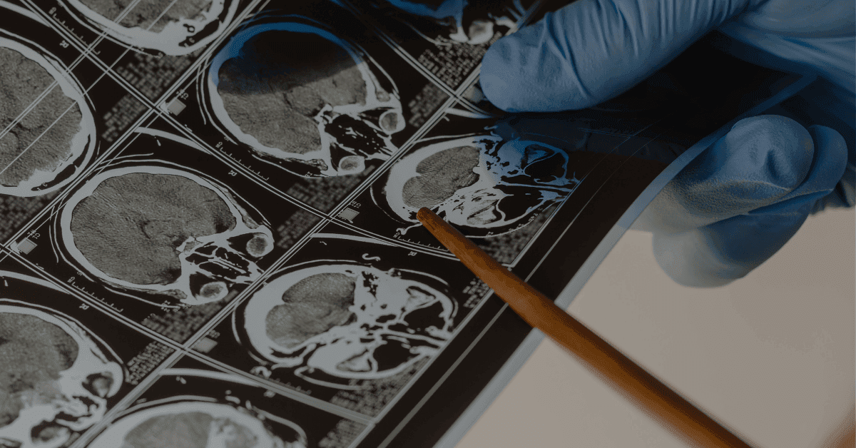 Prudential Panel Neurosurgeons in Singapore