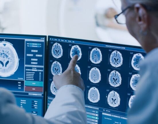 ct scan vs mri​