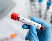 hiv test cost singapore