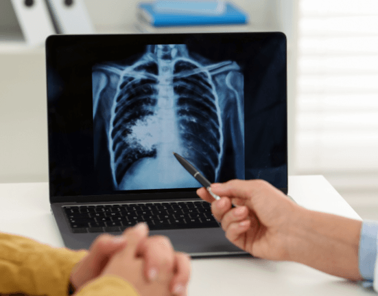 lung cancer screening cost