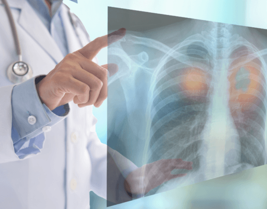 lung cancer singapore
