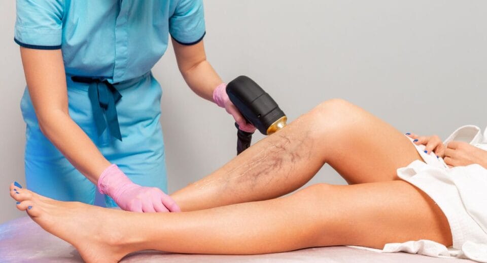 varicose veins treatment singapore cost